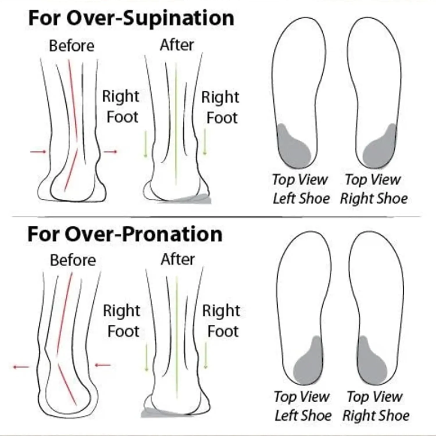 Women's Soft Sole Mesh Comfort Orthopedic Shoes, Walking Shoes Women Comfort, Comfortable Walking Shoes Arch Support